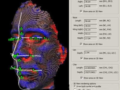核素显像技术为啥这么厉害？咱今天就来唠唠它的好处