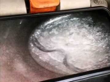 光影之间，病无所遁：那些让医生拥有“超能力”的内窥镜新技术