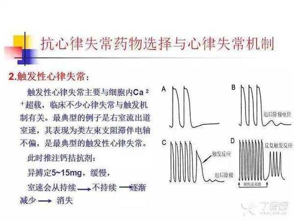 心跳的智能管家：当人工智能成为抗心律失常的“超级大脑”